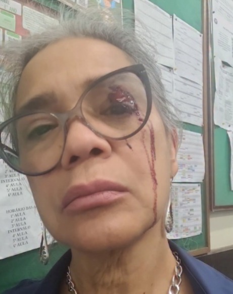 Professora é agredida a socos por aluno em colégio cívico-militar de Londrina (PR)